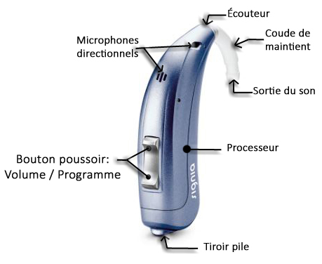 aide-auditive-contour-dore